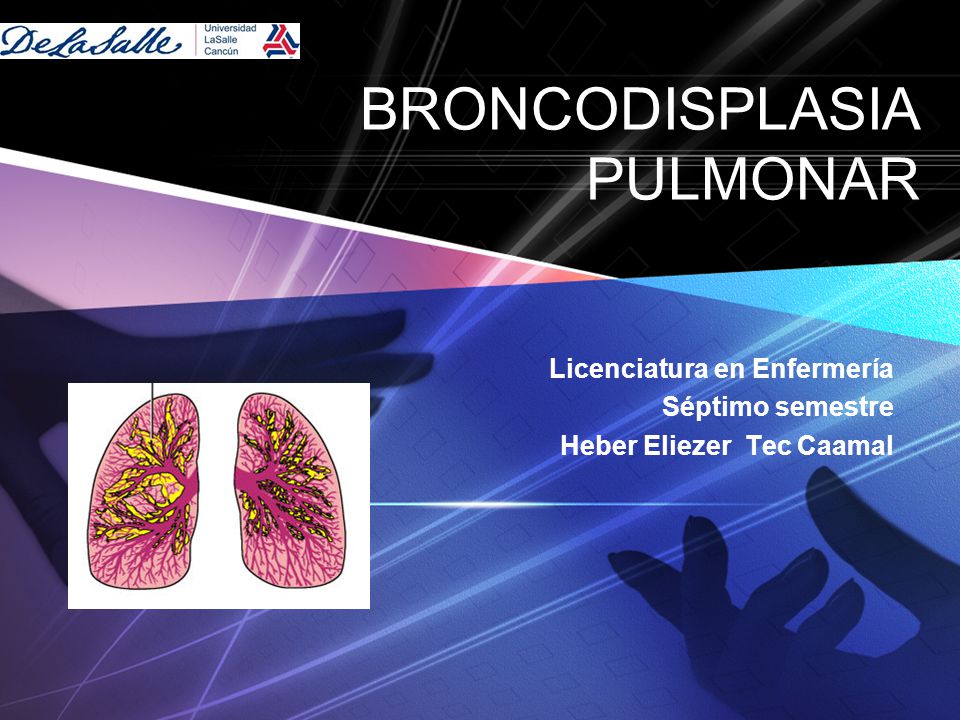 broncodisplasia pulmonar en prematuros